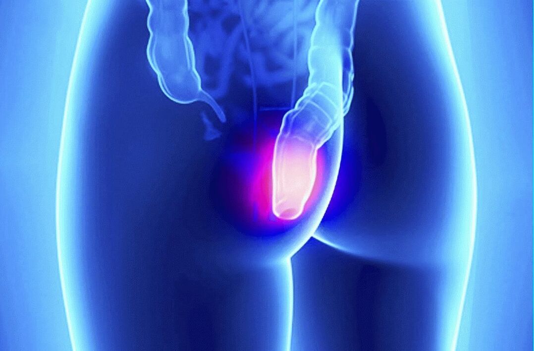 Gelarex pode ser usado externamente e por via retal